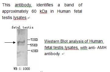 Anti-AMH