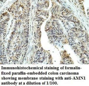 Anti-AMN1