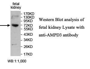 Anti-AMPD3