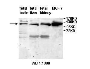 Anti-ANAPC2