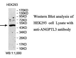 Anti-ANGPTL3
