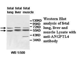Anti-ANGPTL4
