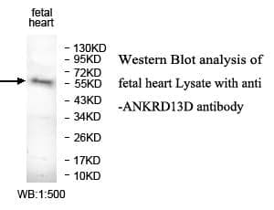 Anti-ANKRD13D