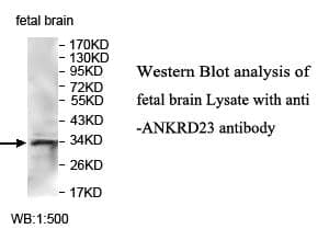 Anti-ANKRD23