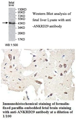 Anti-ANKRD29