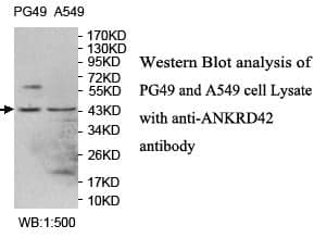 Anti-ANKRD42
