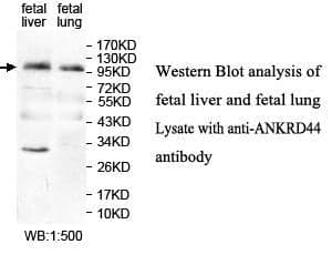 Anti-ANKRD44