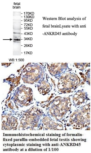 Anti-ANKRD45