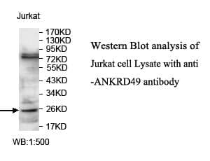 Anti-ANKRD49