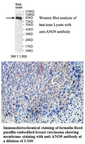 Anti-ANO9