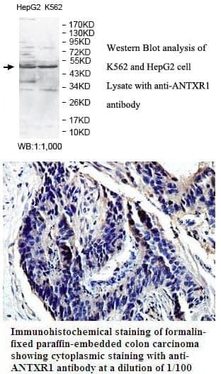 Anti-ANTXR1