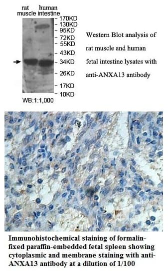 Anti-ANXA13