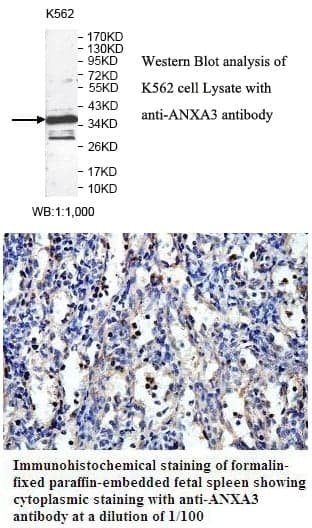 Anti-ANXA3