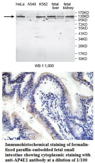 Anti-AP4E1
