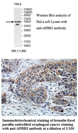 Anti-APBB3
