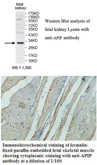 Anti-APIP