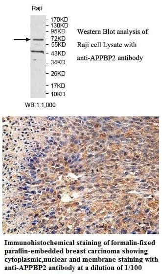 Anti-APPBP2
