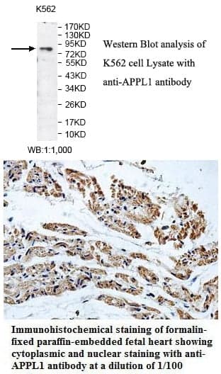 Anti-APPL1