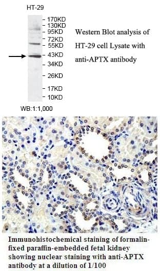 Anti-APTX
