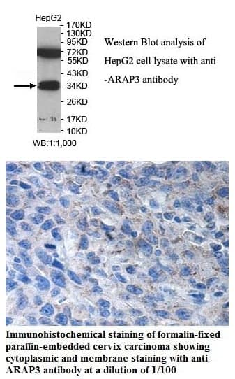 Anti-ARAP3