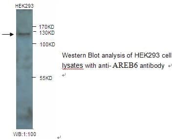 AREB6