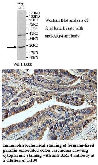 Anti-ARF4