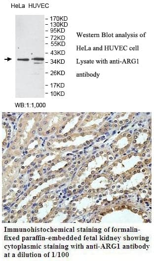 Anti-ARG1