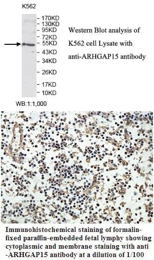 Anti-ARHGAP15