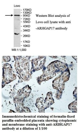 Anti-ARHGAP17