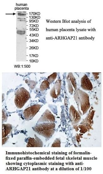 Anti-ARHGAP21