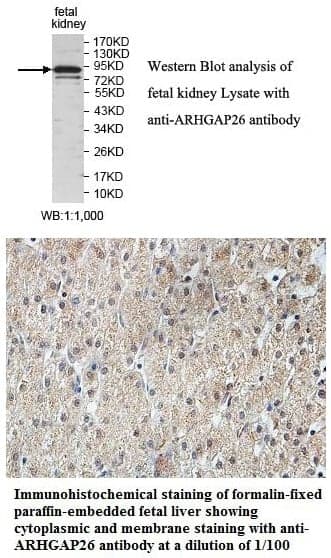 Anti-ARHGAP26