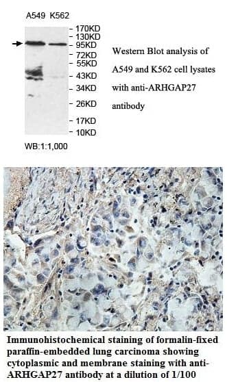 Anti-ARHGAP27