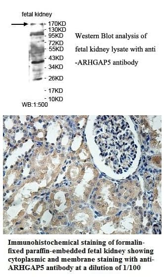 Anti-ARHGAP5
