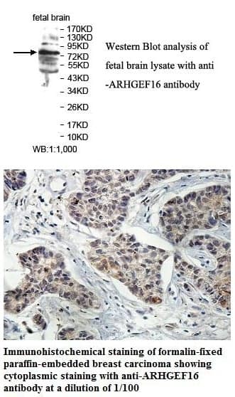Anti-ARHGEF16
