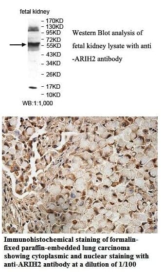 Anti-ARIH2
