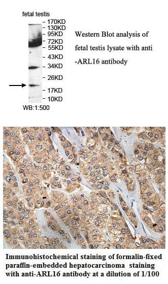 Anti-ARL16