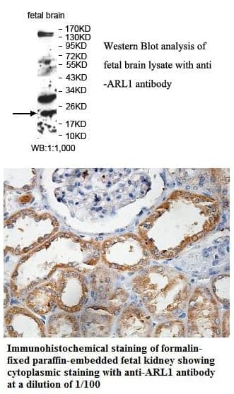 Anti-ARL1
