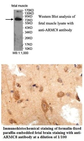 Anti-ARMC8