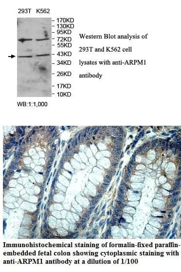 Anti-ARPM1