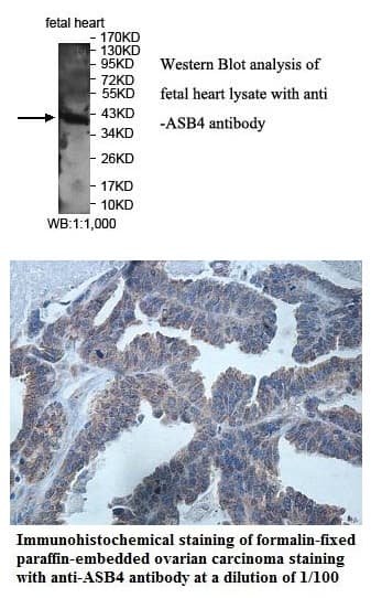 Anti-ASB4
