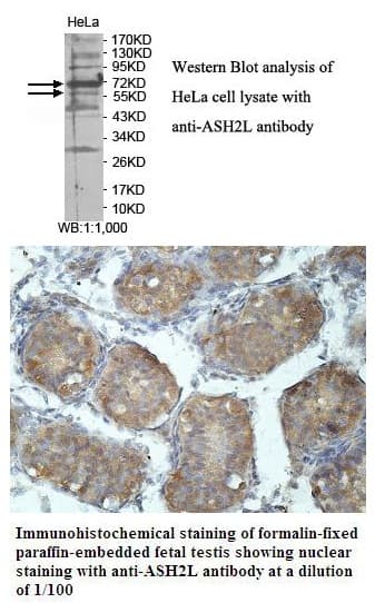 Anti-ASH2L