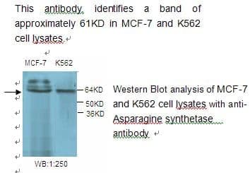 Anti-Asparagine synthetase