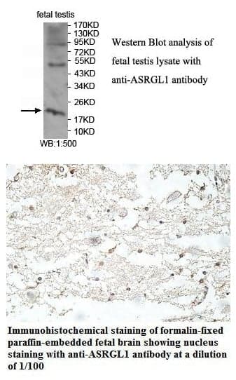 Anti-ASRGL1
