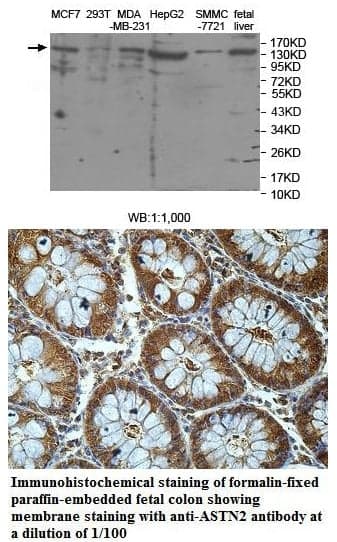 Anti-ASTN2