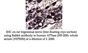 Anti-Human ATPase (195-209)