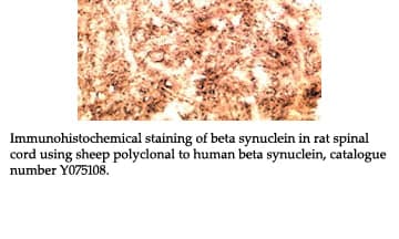 Anti-beta synuclein (108-125)