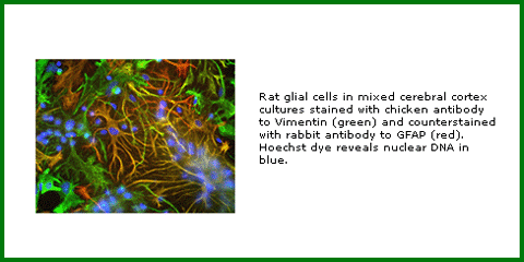 Anti-Vimentin (Chicken Polyclonal)