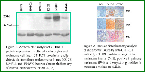 Anti-CTHRC1 (Rabbit Polyclonal)