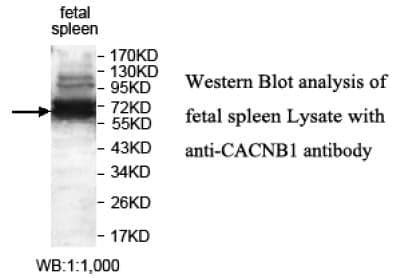 Anti-CACNB1