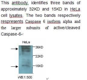 Anti-Caspase 6